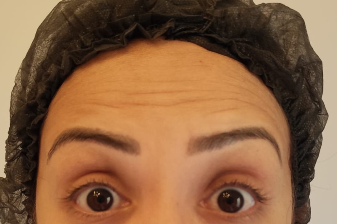 Antes